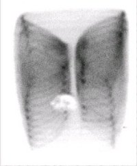 image1-kl